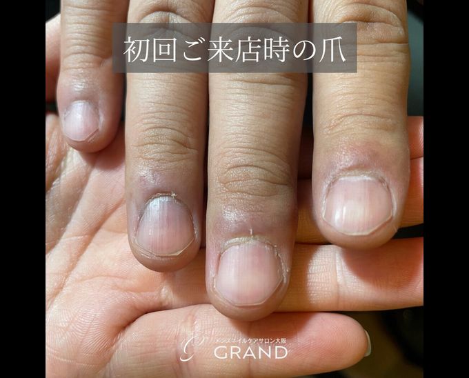 ネイルケアで爪は変わります ネイルケア メンズネイルケアサロン大阪グランド